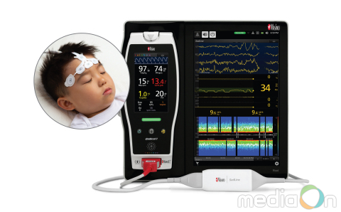 마시모, 차세대 세드라인 뇌기능 모니터링 기기에 대한 소아과 환자 사용 CE 마크 허가 받아